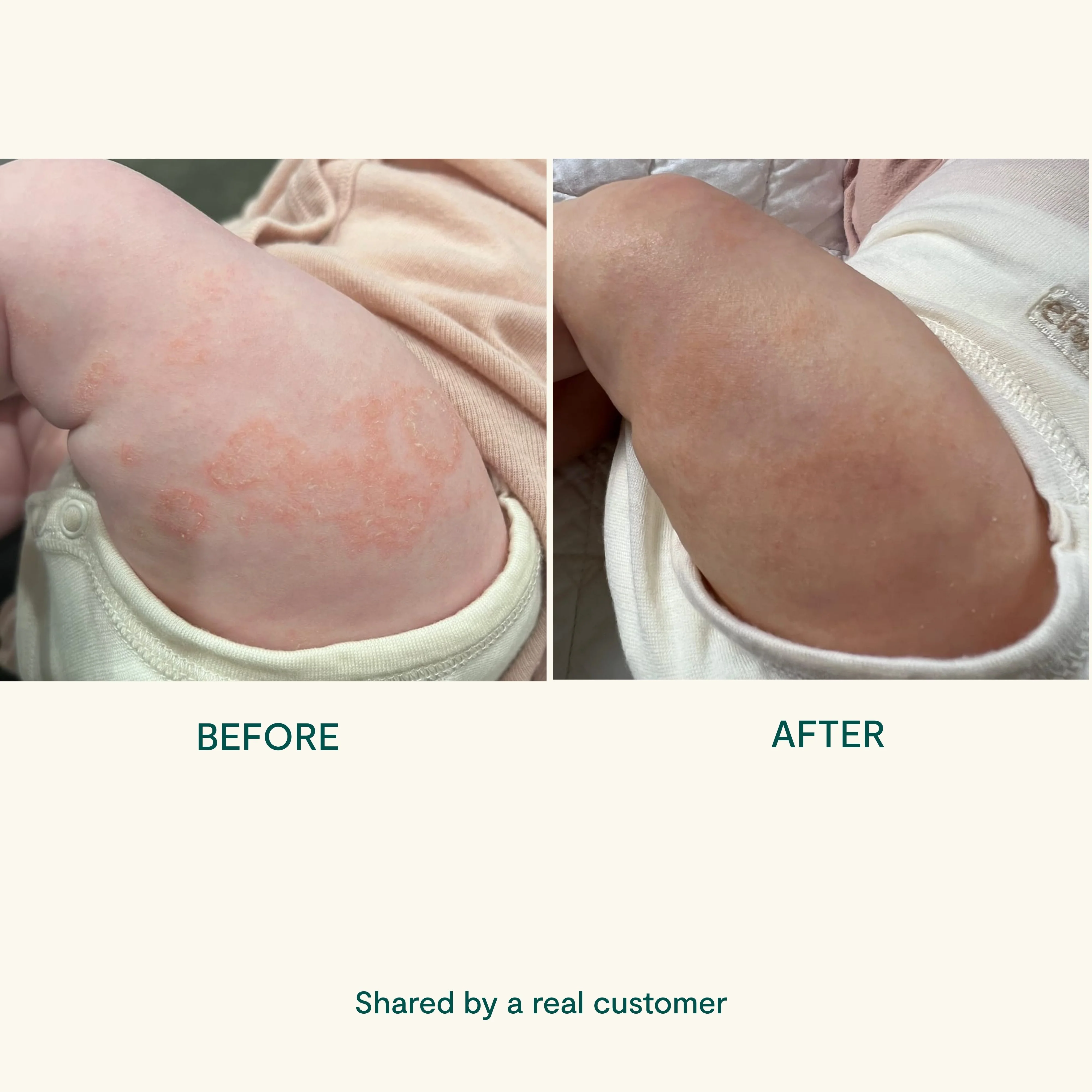 BEETL Baby Cream 250ml - Image 7
