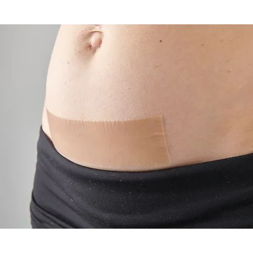 Myscar Caesarean Silicone Strips - The Original - Image 3
